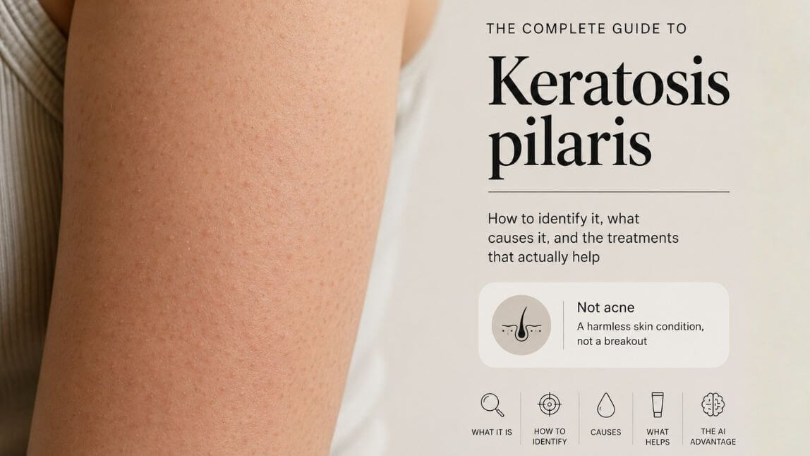 Keratosis Pilaris vs Acne: How to Tell Those Bumps Apart