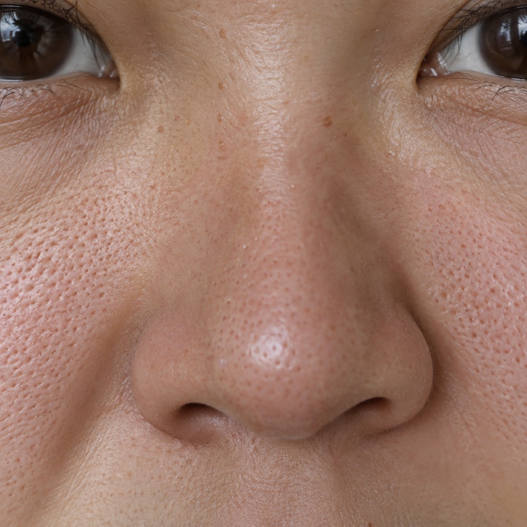 pores analysis pores analysis