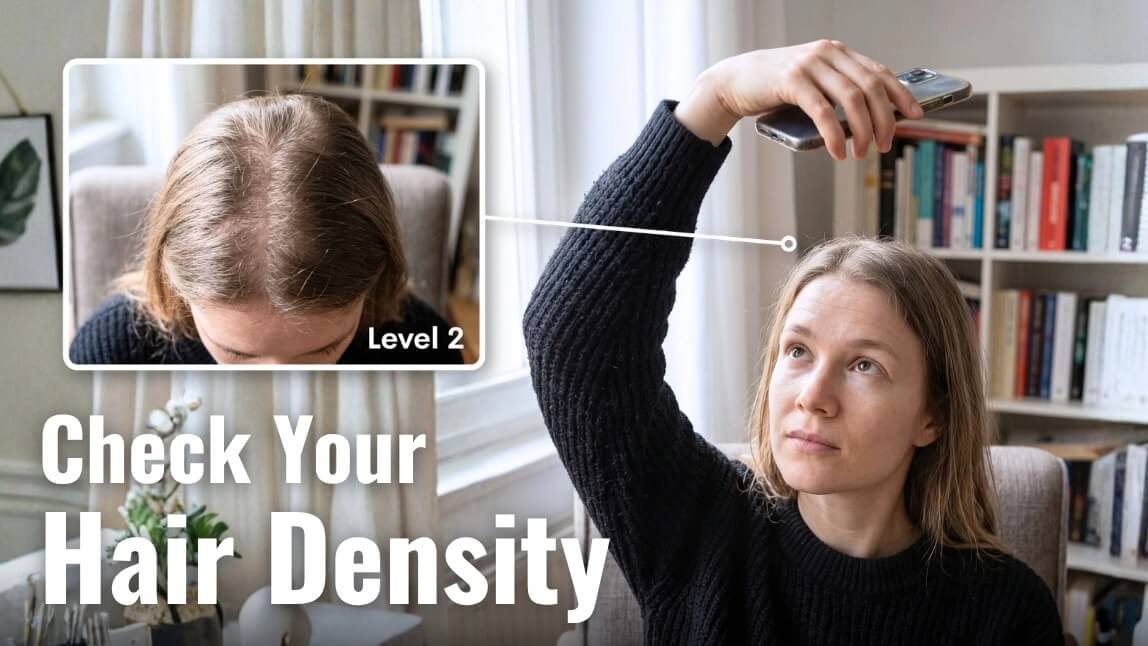 How to Check Hair Density: 5 Easy Tests, Normal Ranges and an AI Scan