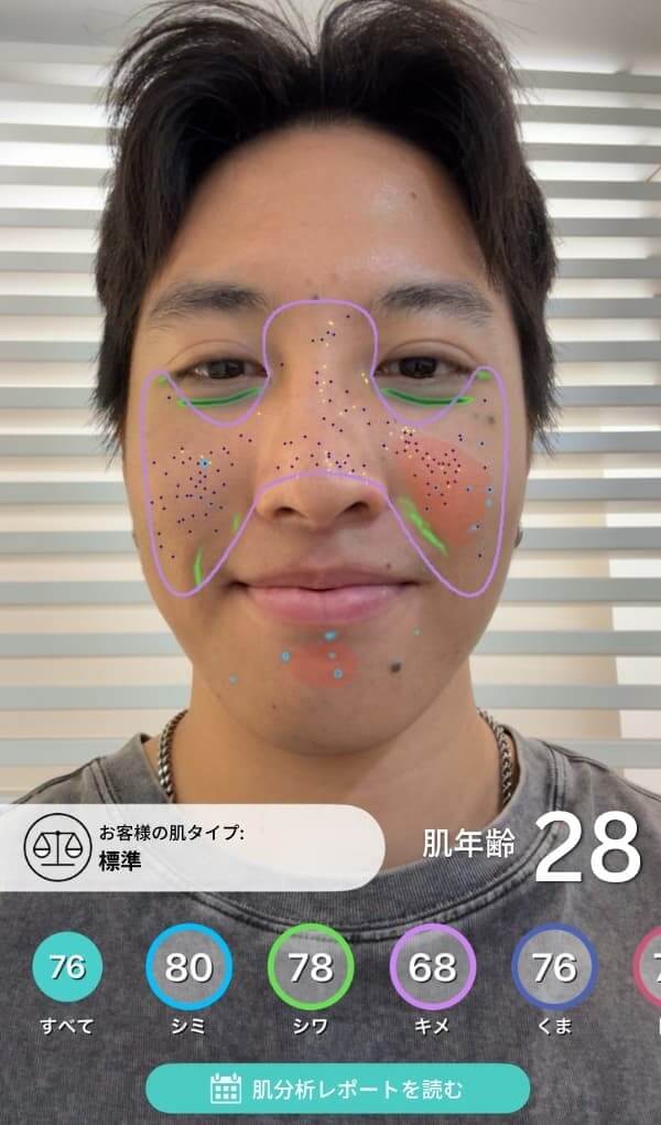 アプリで自分の肌年齢も測定できる アプリで自分の肌年齢も測定できる