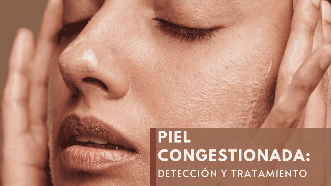 Piel congestionada con comedones y poros abiertos
