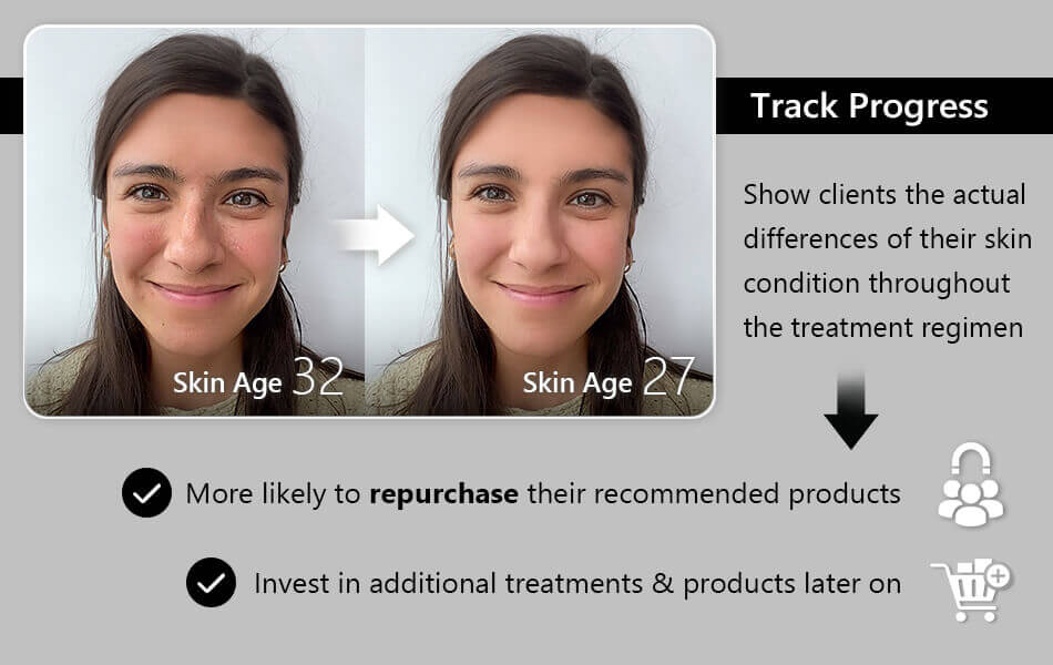 skin analyzer tracking