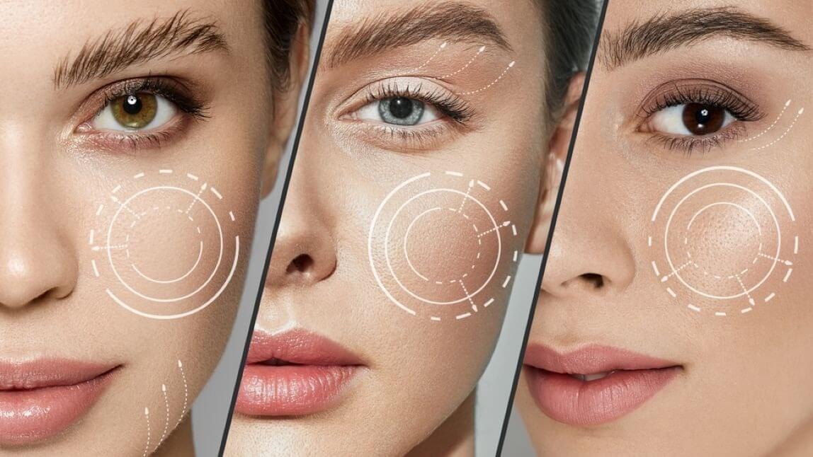 skin tightening