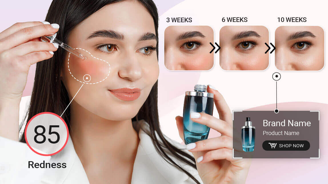 AI Skin Analyzer AI Skin Analyzer