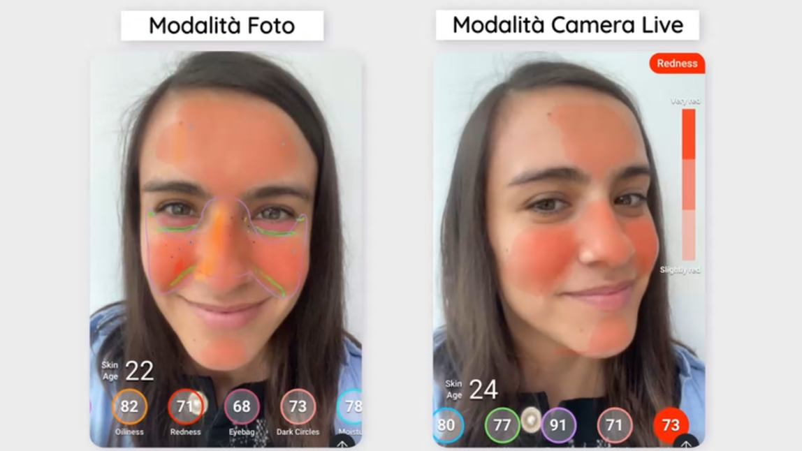Analisi della Pelle AI
