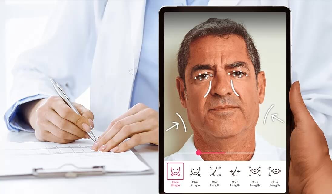 Paciente viendo su cambio con prueba de bichectomía online