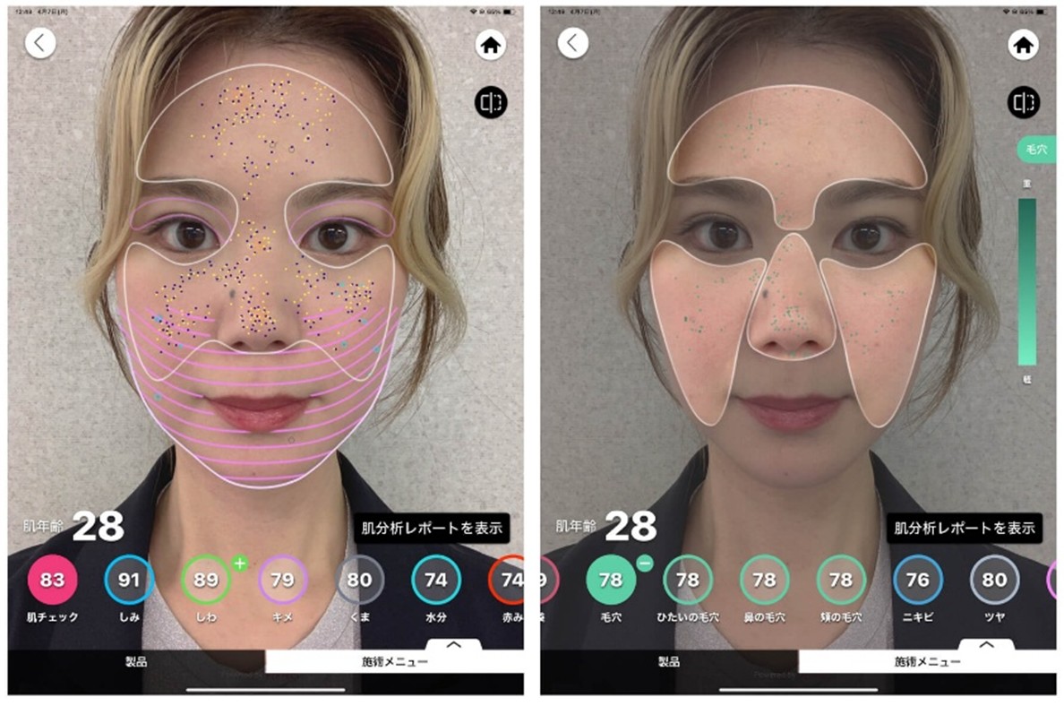 肌診断使用イメージ