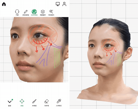 AI 비전 기술로 메디컬 뷰티의 미래를 그리는 킨사이트