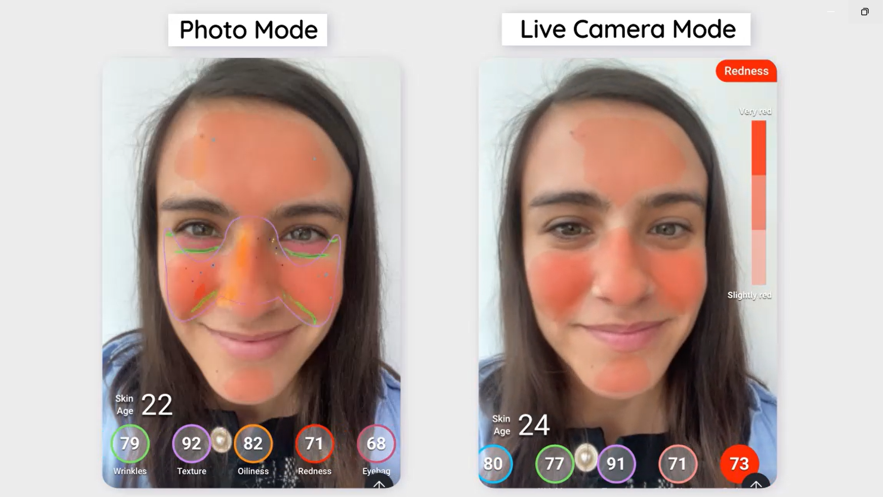 real time skin analyzer