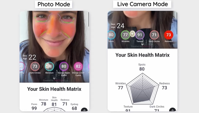 skin analysis