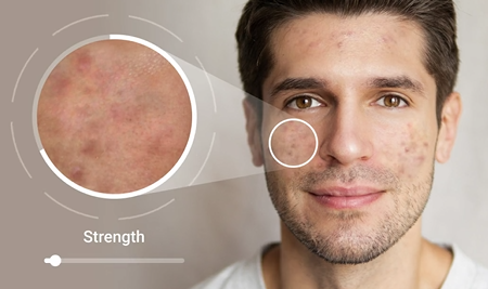 skin simulation