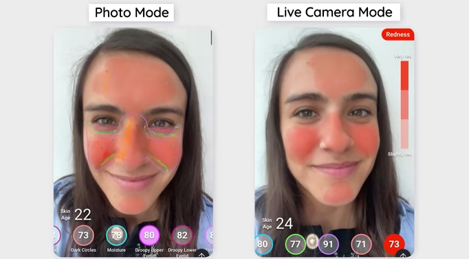 skin analysis