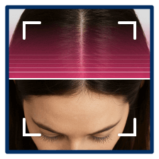 Analyze and Categorize Hair Density Level