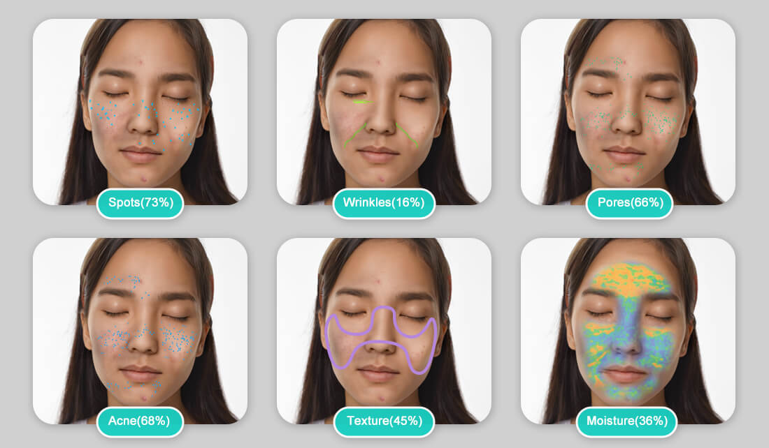 What does skin imaging system offer?