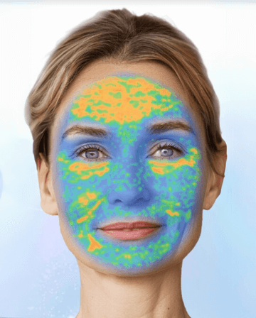 Skin Hydration