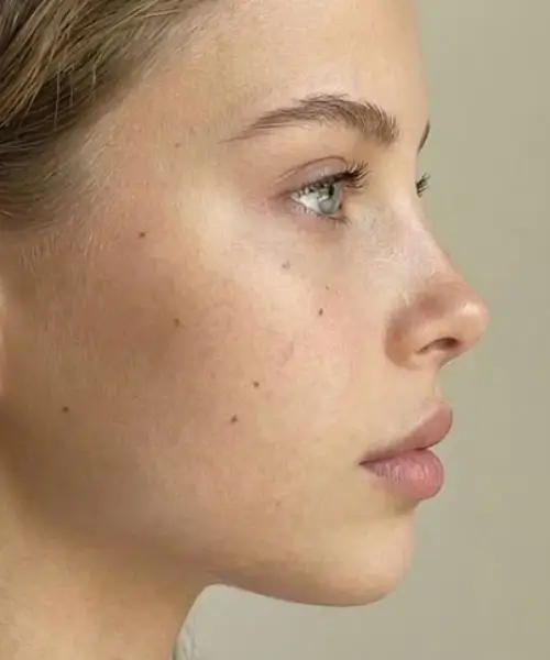 Button Nose