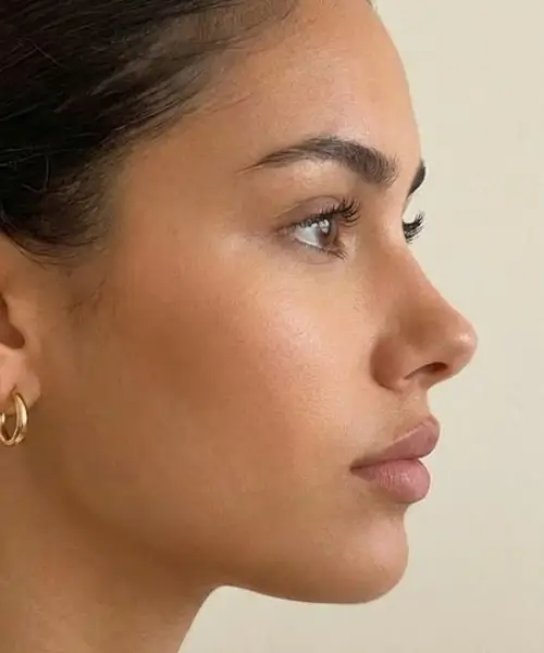 Upturned Nose