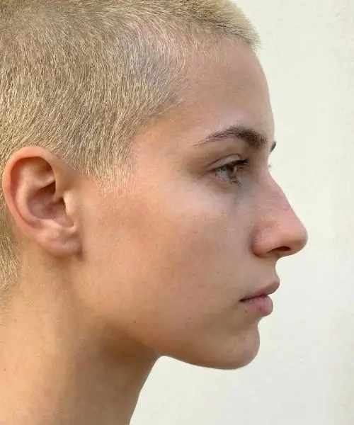 Bumpy Nose