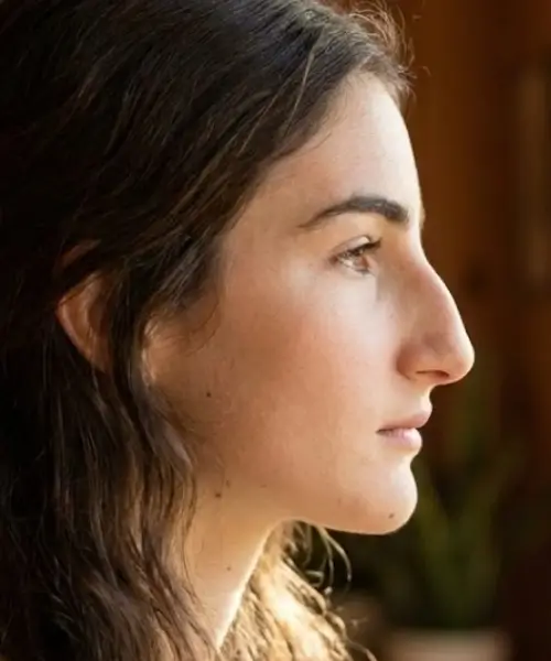 Greek Nose