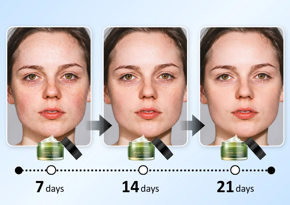 AI Skin Simulation