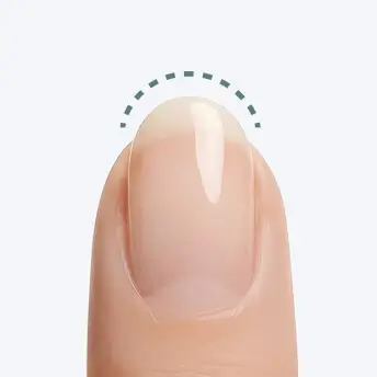 Oval