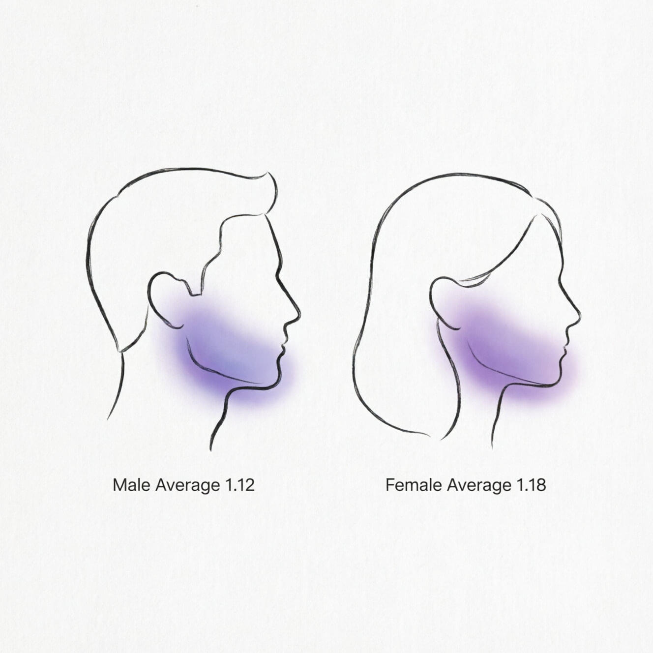 Comparison chart of bigonial width ratio ranges by gender