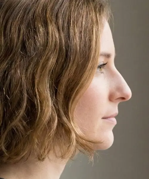 Straight Nose