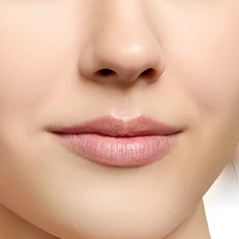 Lip Shape
