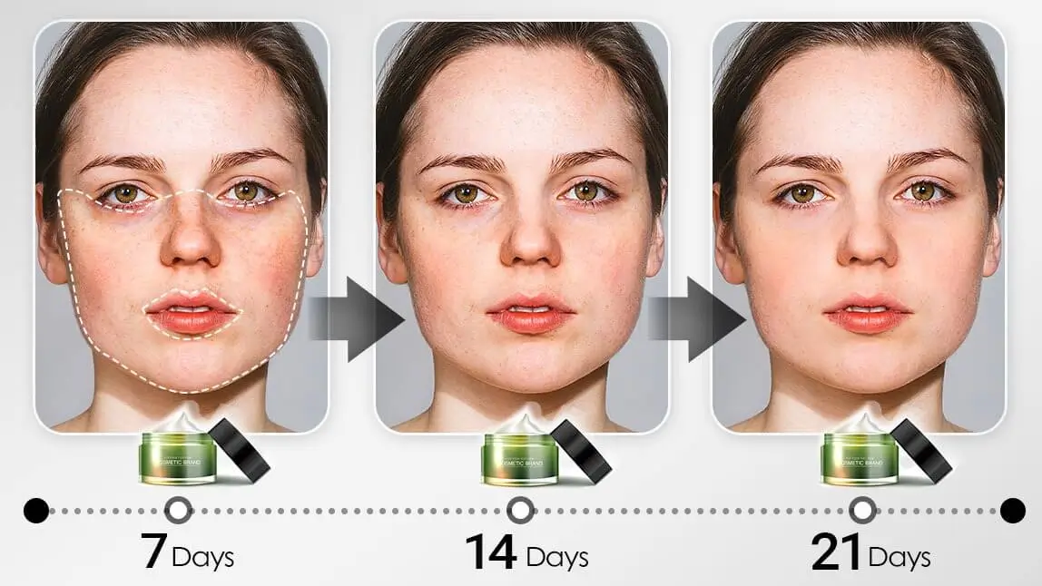 AI Skin Simulation
