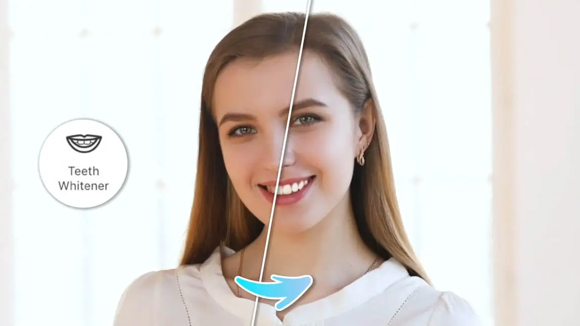 Blanqueamiento dental con IA