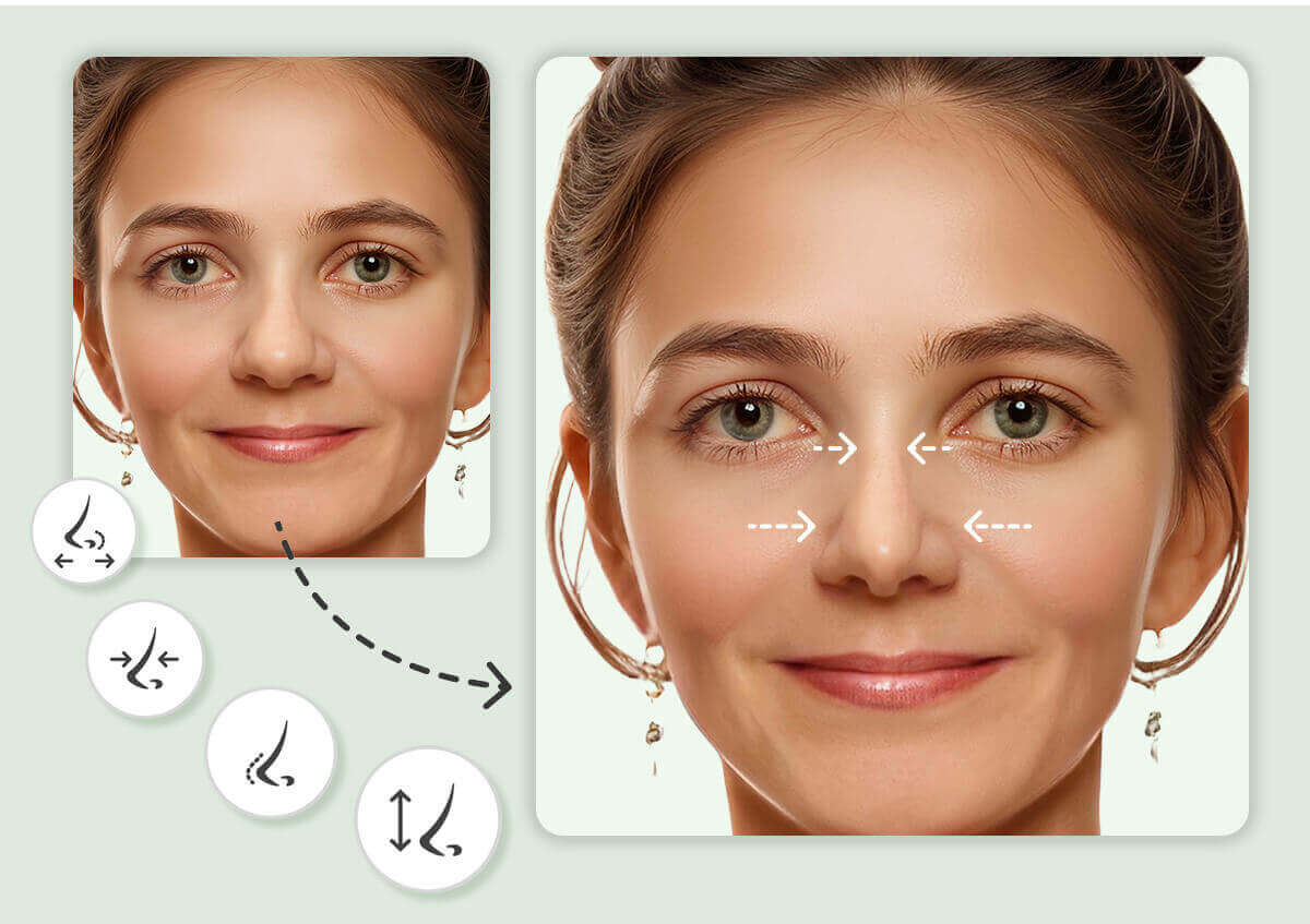 Nose Reshape Simulator