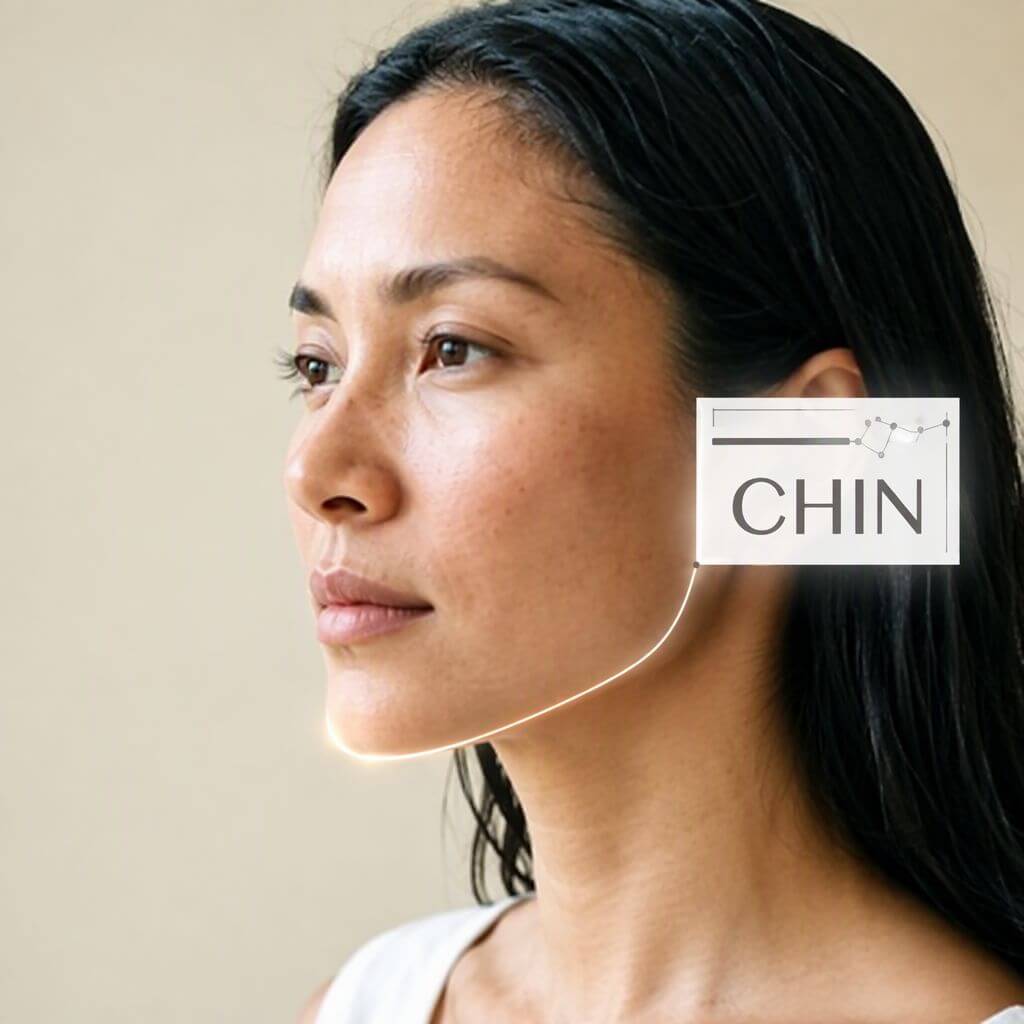 AI chin filler before and after simulation showing chin projection change