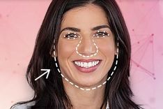 Remodelación Facial con AI
